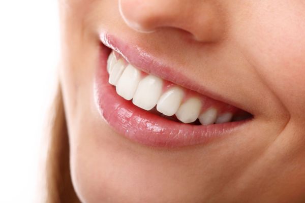 Um sorriso d euma mulher, com os dentes bem brancos e saudáveis